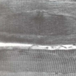 טריגר פוינט בפאציה הדמיה אמיתית - גבעון פלד מומחה להפגת כאב